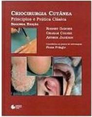 Criocirurgia Cutânea: Princípios e Prática Clínica