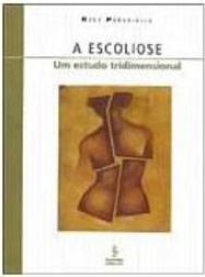 A Escoliose: um Estudo Tridimensional