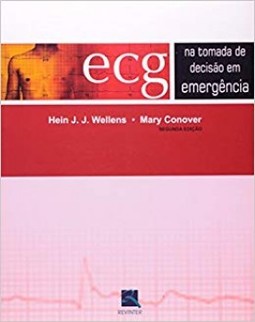 ECG na tomada de decisão em emergência
