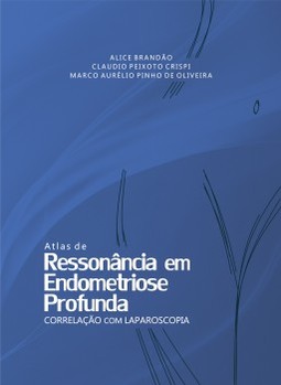 Atlas de ressonância em endometriose profunda: correlação com laparoscopia