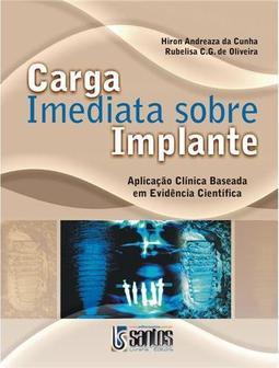Carga Imediata Sobre Implante