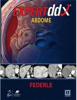 Expertddx - Abdome