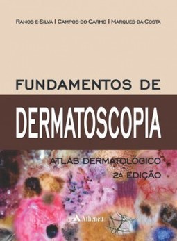Fundamentos de dermatoscopia: Atlas dermatológico