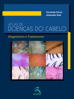 Atlas de doenças do cabelo: diagnóstico e tratamento