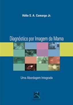 Diagnóstico por imagem da mama: uma abordagem integrada