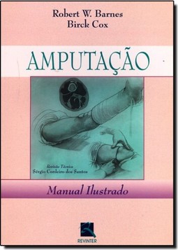 Amputação