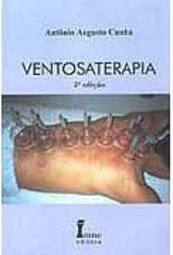 Ventosaterapia