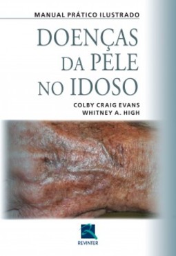Doenças da pele no idoso: manual prático ilustrado