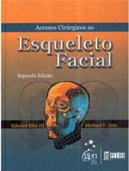 Acessos cirúrgicos ao esqueleto facial